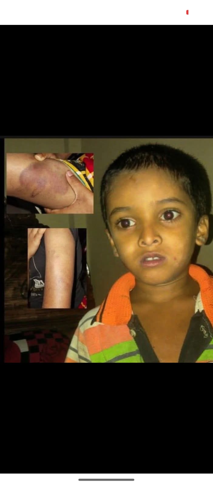 গফরগাঁও বারইল মাদ্রাসার রোজাদার ছাত্রকে পিটিয়ে গুরুতর আহত করেছে।