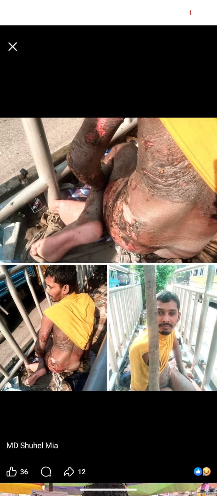 শরীরের মাংসগুলো পচে যাচ্ছে, জীবনটা বেচে যেতো সাহায্য পেলেই। 